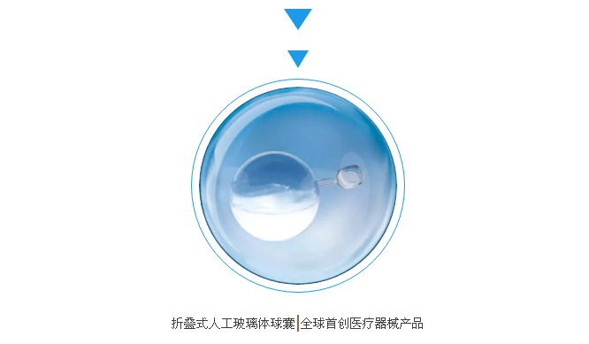 人工玻璃体球囊图片